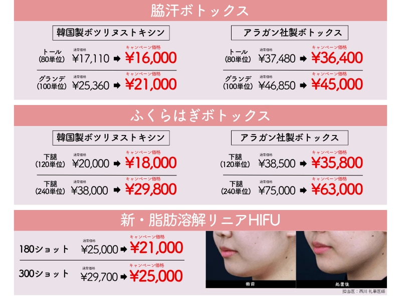 湘南美容クリニック　池袋西口院　4月　キャンペーン　安い　脇汗　ボトックス　下腿　美脚　HIFU たるみ　若返り　症例